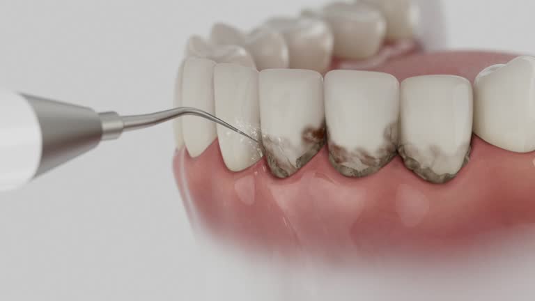 Reliable Dental Implants contractor in Bayshore, NC by Smile Center Dentistry